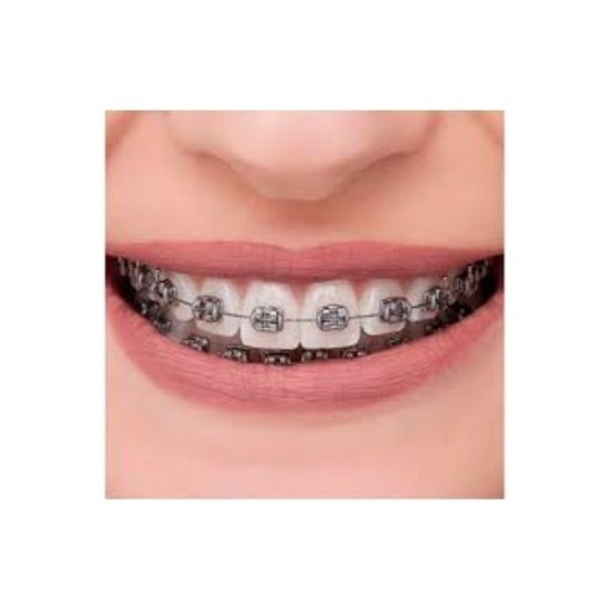 BRACKET METAL BRIGHT SERIES ROTH .022 SET